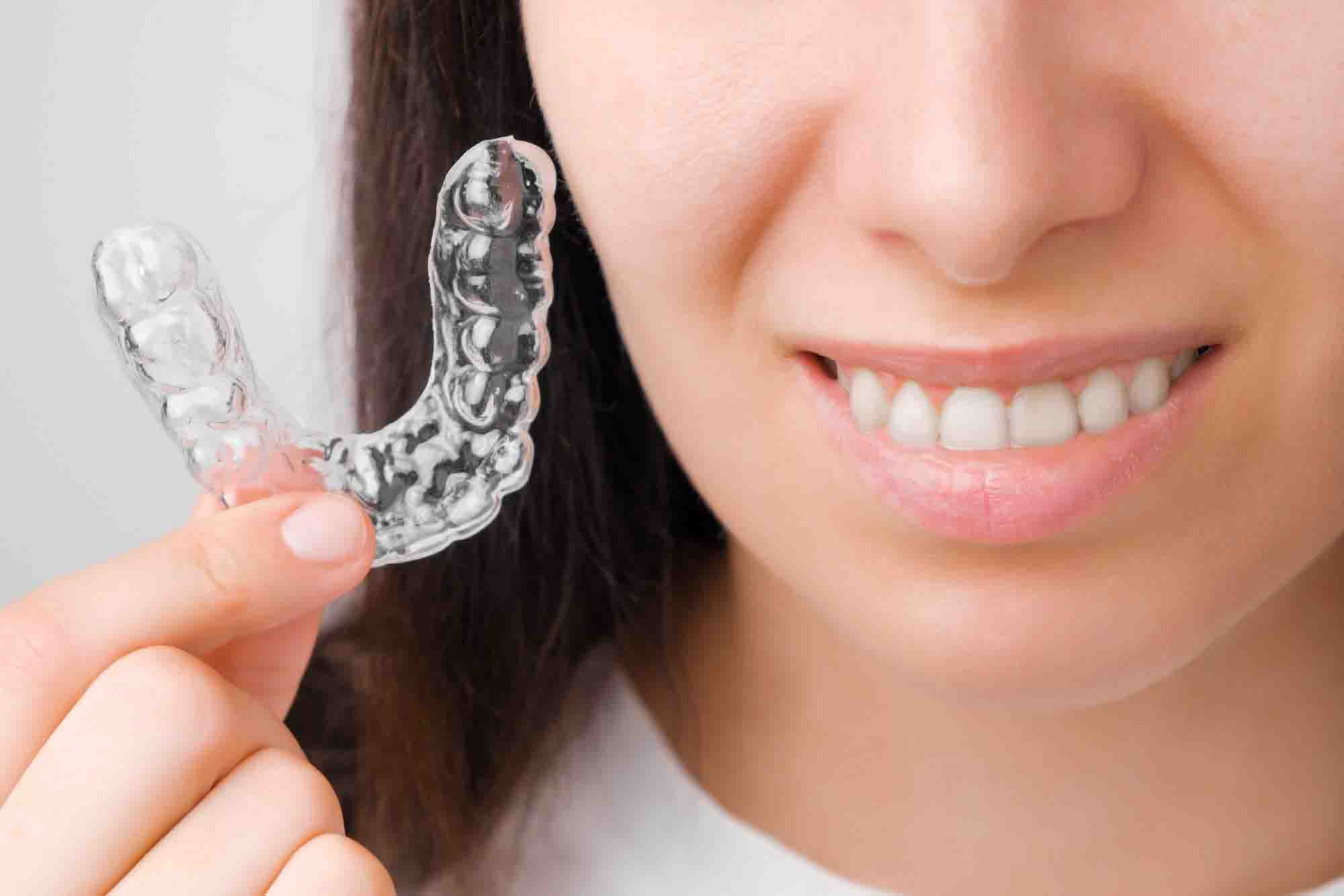 Invisalign Murcia