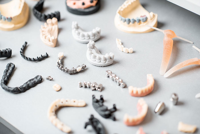 implantes dentales en murcia