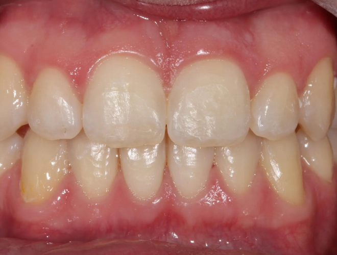 After image