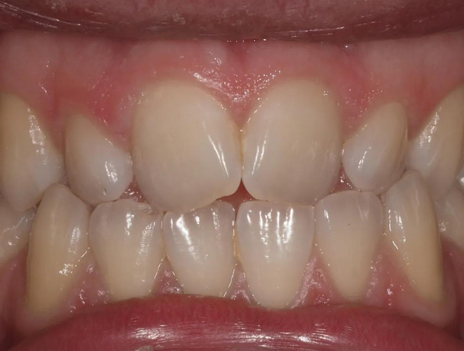 Before image